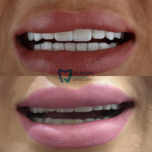 img-161-Dr-Mazen-Doumit-dentist-lebanon