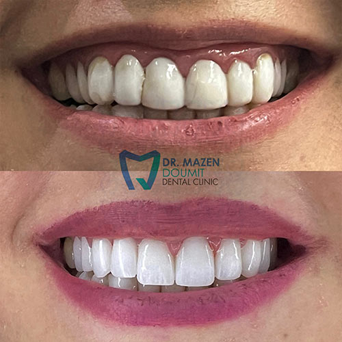 img-163-Dr-Mazen-Doumit-dentist-lebanon