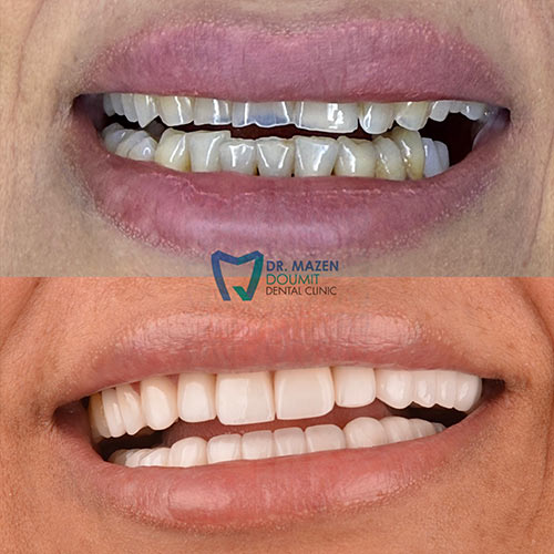 img-165-Dr-Mazen-Doumit-dentist-lebanon