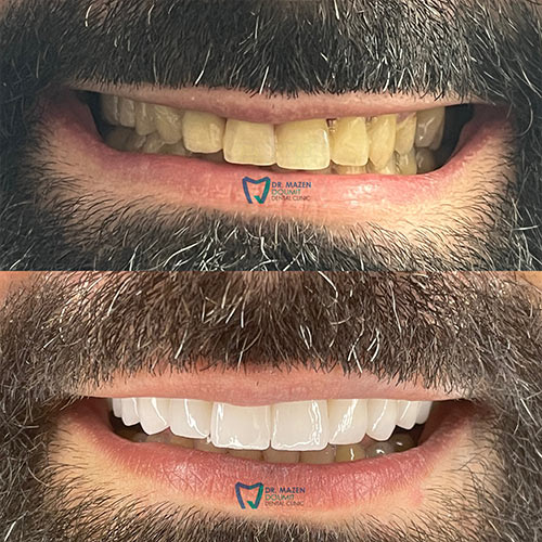 img-174-Dr-Mazen-Doumit-dentist-lebanon