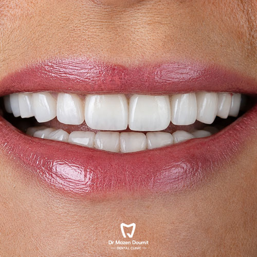 img-213-Dr-Mazen-Doumit-dentist-lebanonsmile 02