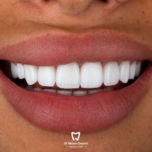 img-213-Dr-Mazen-Doumit-dentist-lebanonsmile 03