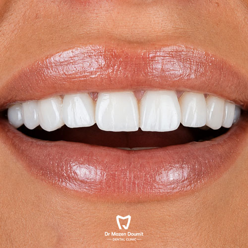 img-213-Dr-Mazen-Doumit-dentist-lebanonsmile 04