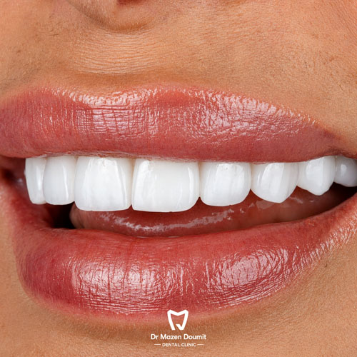 img-213-Dr-Mazen-Doumit-dentist-lebanonsmile 07