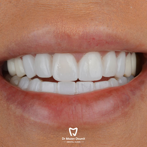 img-213-Dr-Mazen-Doumit-dentist-lebanonsmile 08