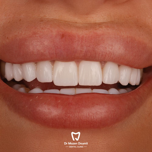 img-213-Dr-Mazen-Doumit-dentist-lebanonsmile 09
