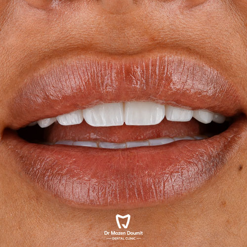img-213-Dr-Mazen-Doumit-dentist-lebanonsmile 10